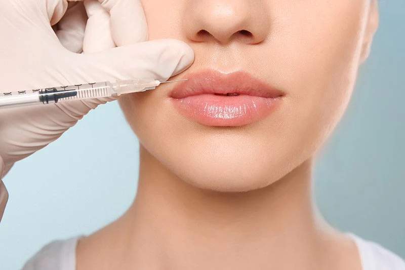 Lip Fillers Dubai Confidence and Beauty in Every Smile