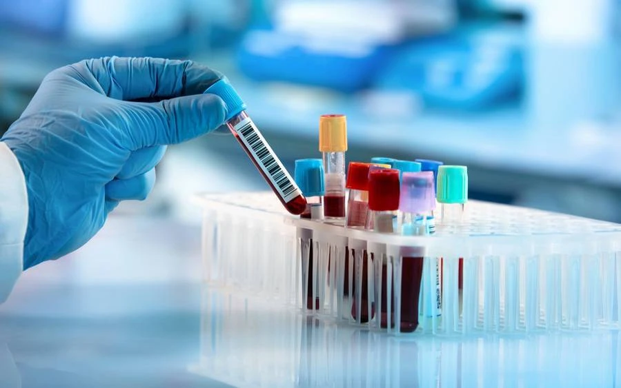 What specific genes are typically analyzed in a liquid profile panel test?