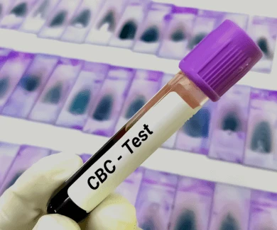 CBC Test in Gurgaon: Importance, Benefits, and How to Book