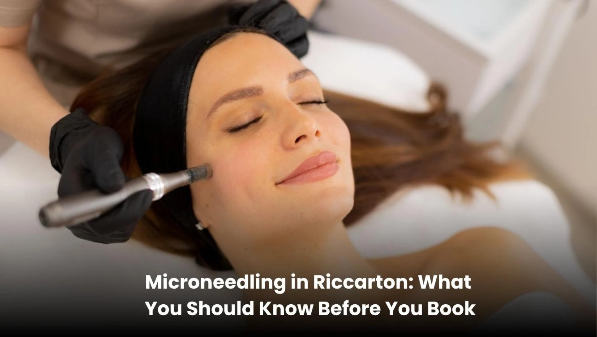 Microneedling in Riccarton: What You Should Know Before Booking Your First Session