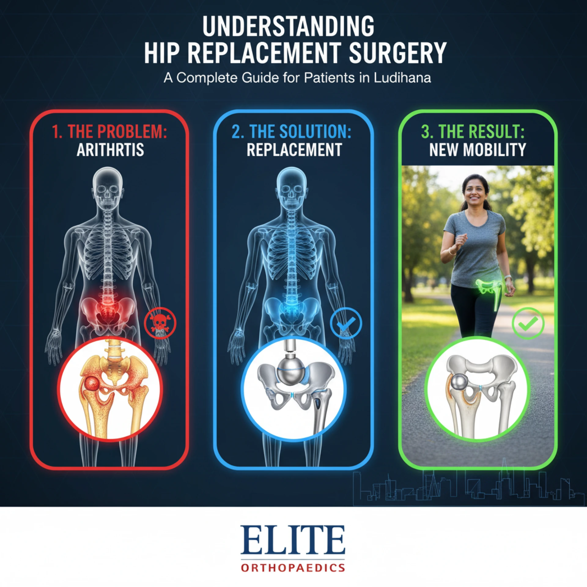 Understanding Hip Replacement Surgery: A Complete Guide for Patients in Ludhiana