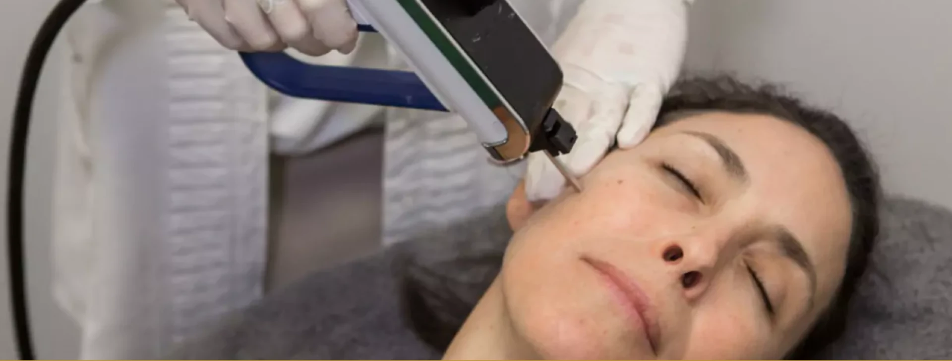 Micro-needling Cape Town: Renew Your Skin with Gentle Collagen Boost