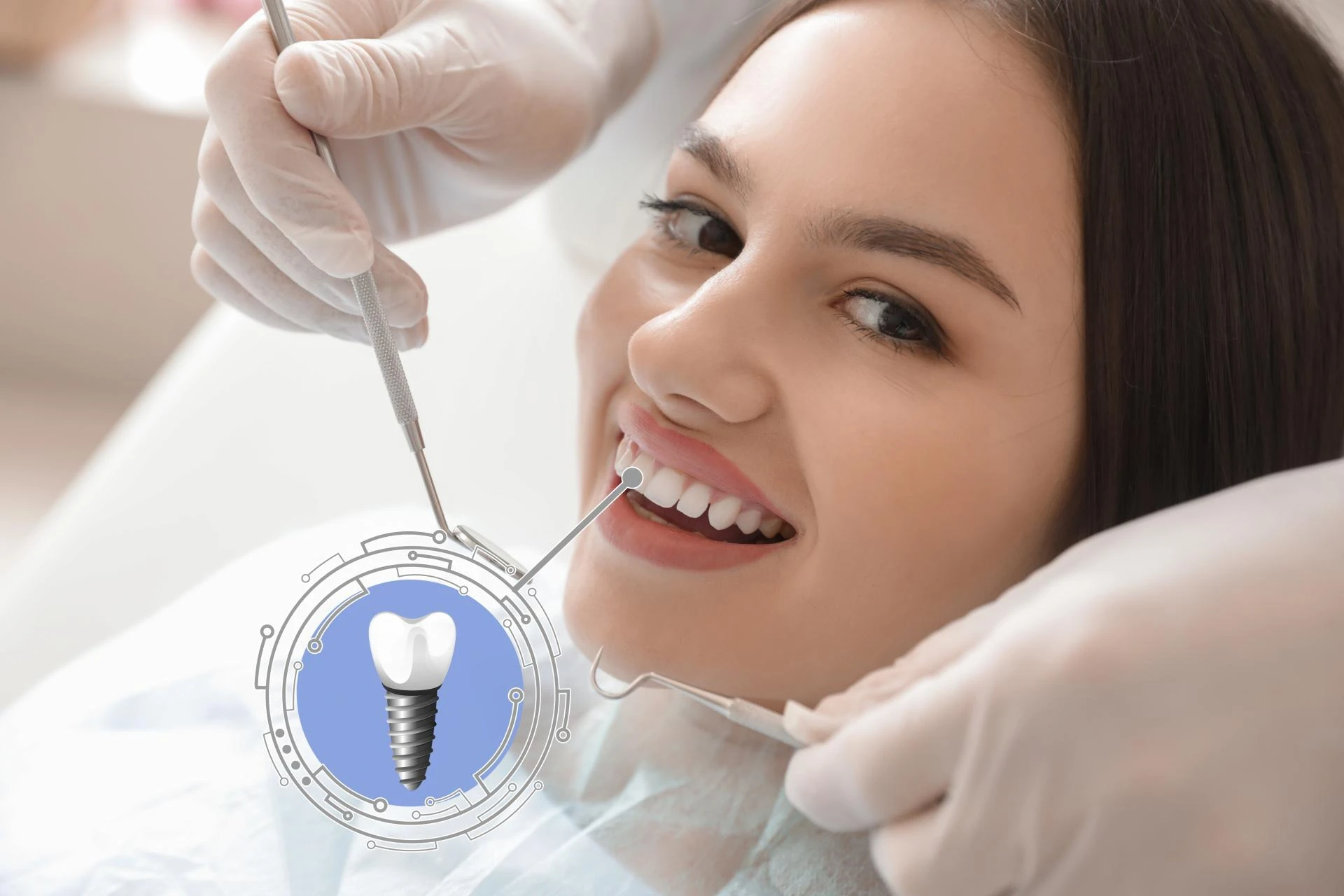 Single Tooth Solutions: Natural, Durable Implants