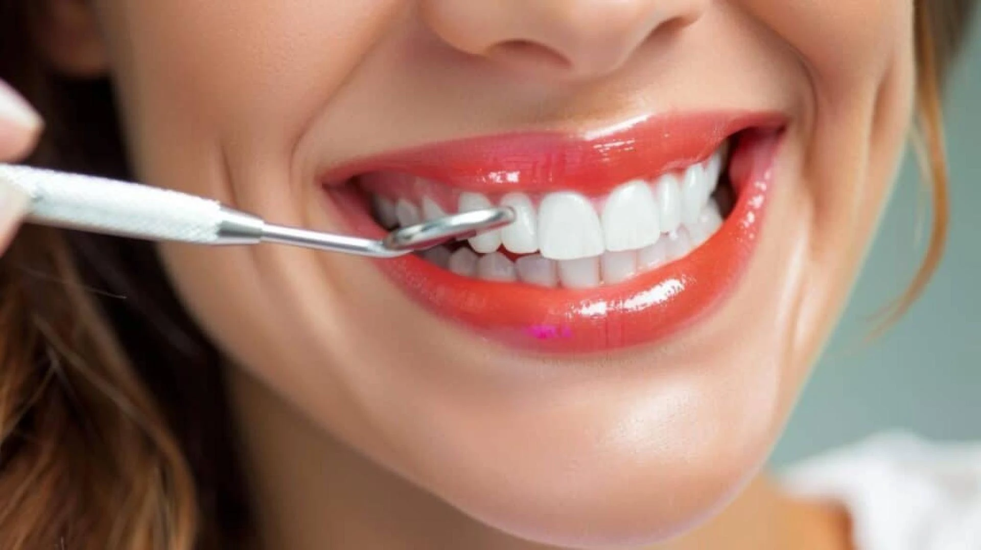 Veneer in Dubai for a Flawless, Celebrity-Style Smile