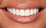 Can Periodontal Disease Be Fully Treated?