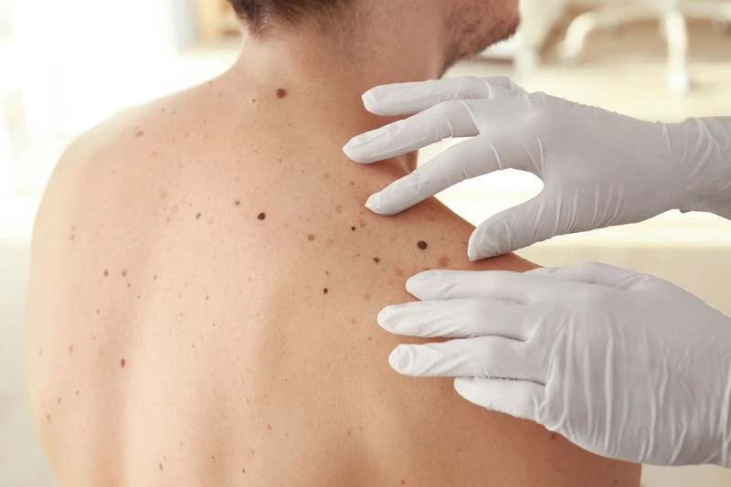 Healthy Skin Starts Here: Top Burleson Dermatologist, Granbury, and Benbrook Providers