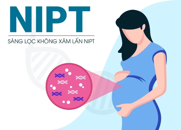 Nhung dieu can biet ve cac xet nghiem NIPT pho bien hien nay
