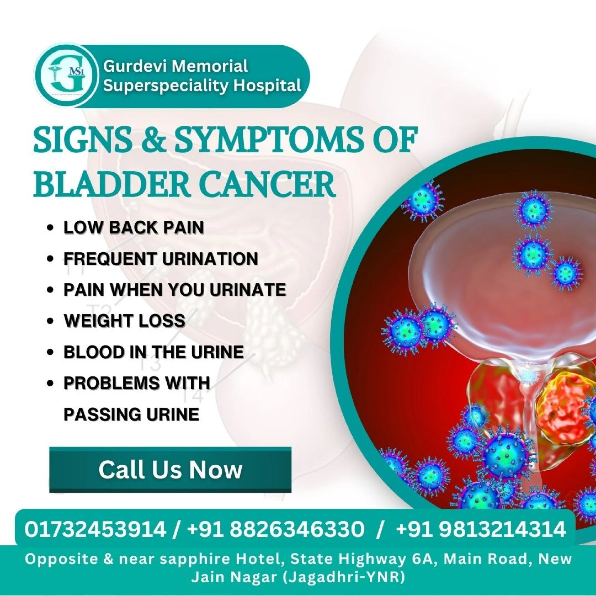 Where Is the Best Place for Bladder Cancer Treatment in Yamunanagar?