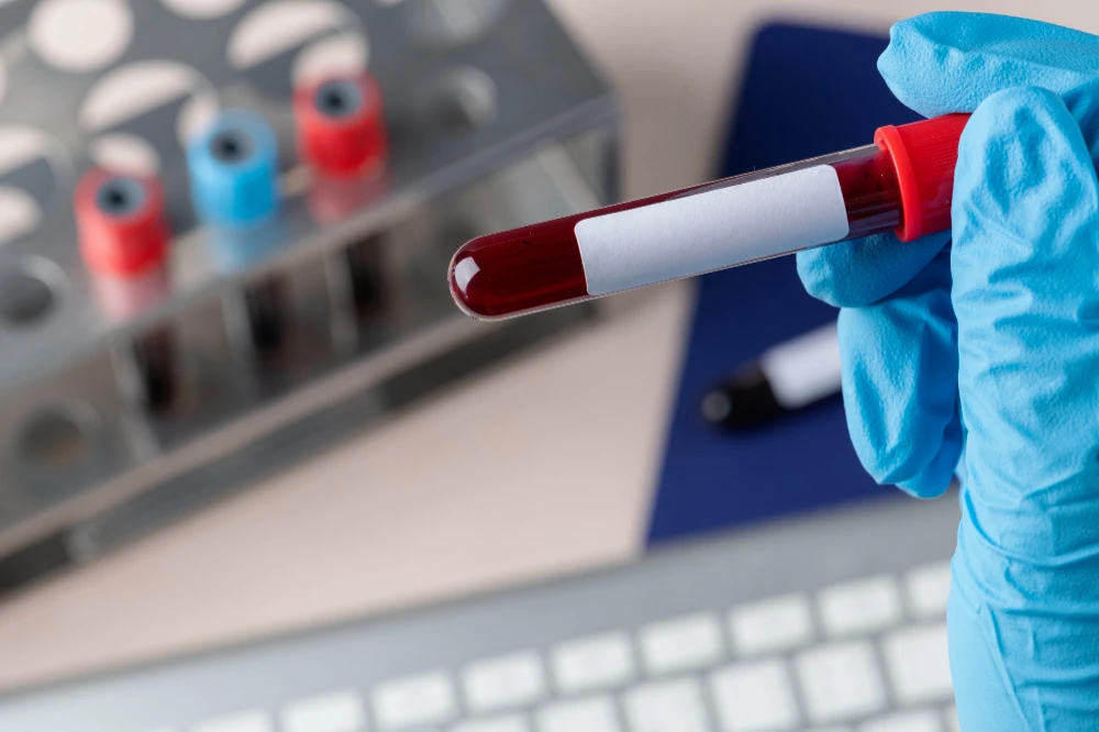 LFT Test Explained: Know Your ALT, AST, Bilirubin & More