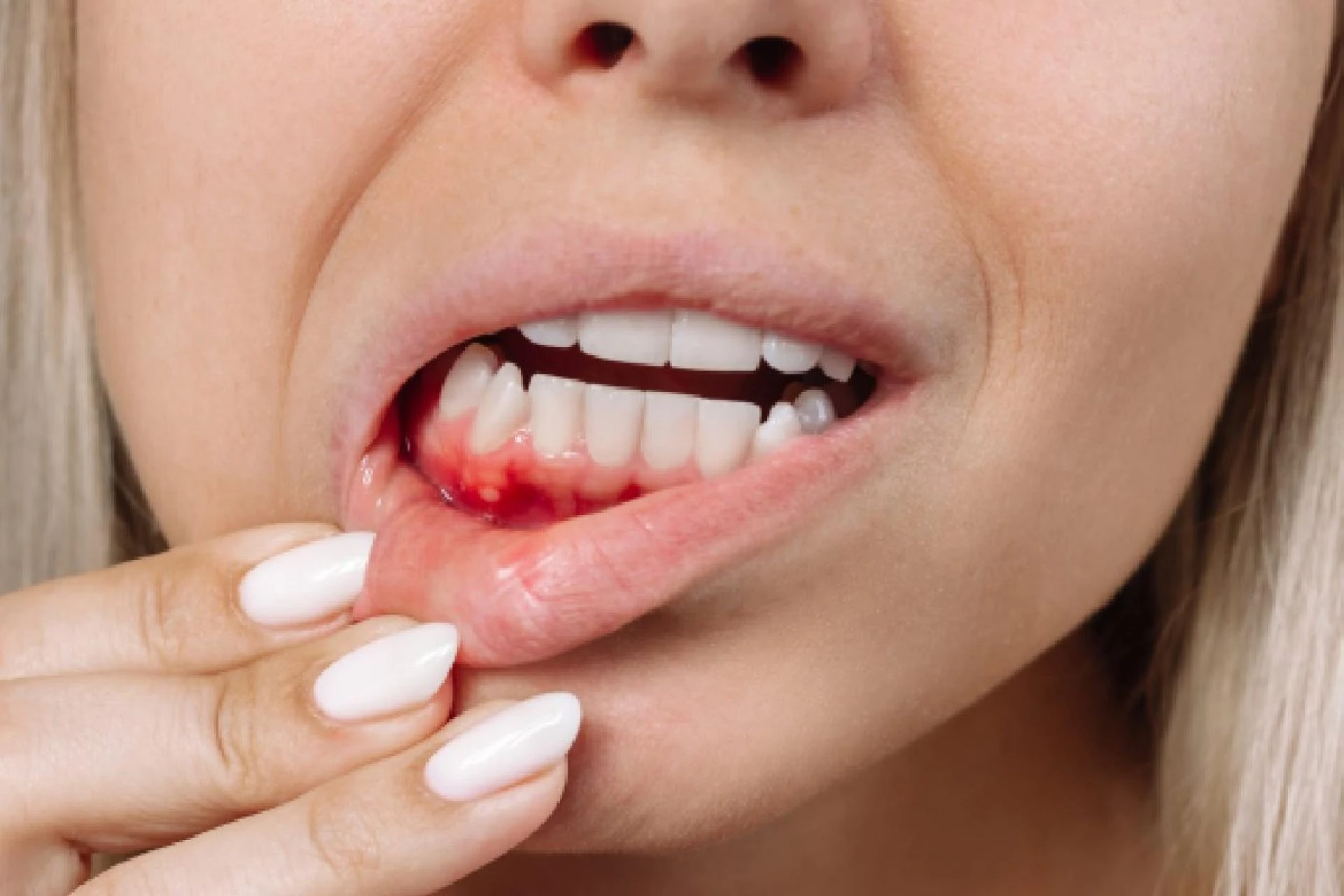 Gum Surgery in Gurugram Sector 47: Restoring Gum Health for a Stronger, Healthier Smile