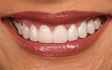 Why Choosing a Local Cosmetic Dentist Near Me Matters