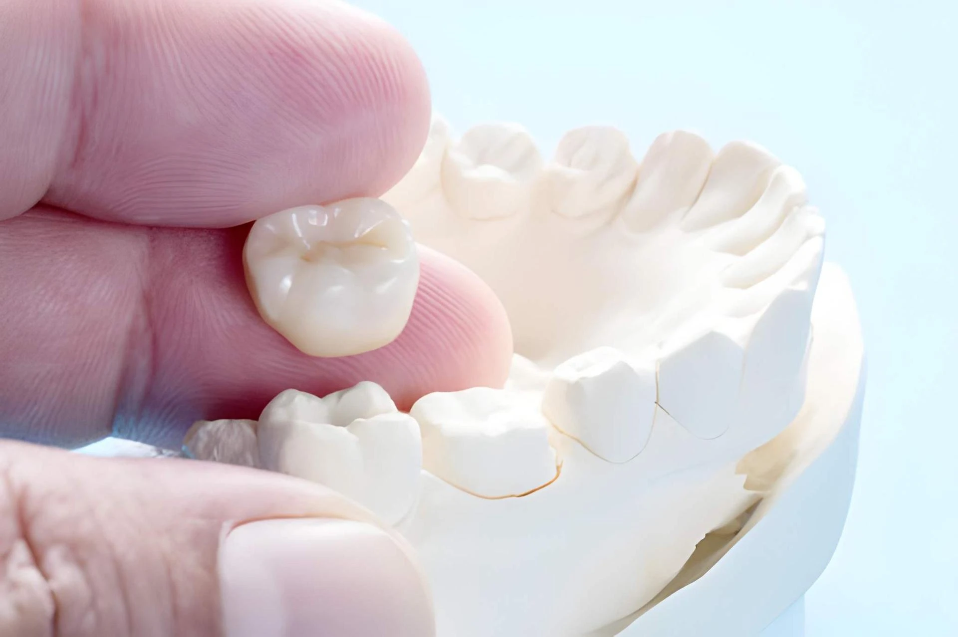 Restoring Smiles with Dental Crowns: Expert Care at The Dental Co. of Leesburg