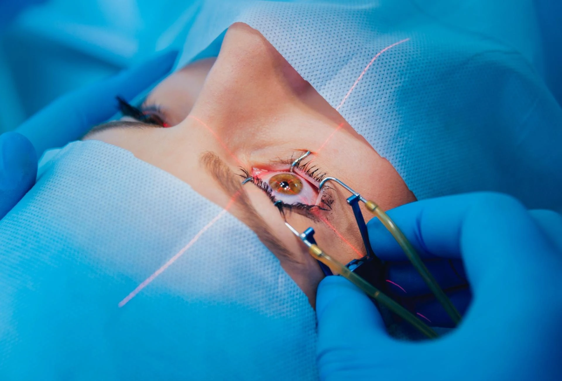 How Much Is a SMILE Surgery? Pricing, Factors, and Savings