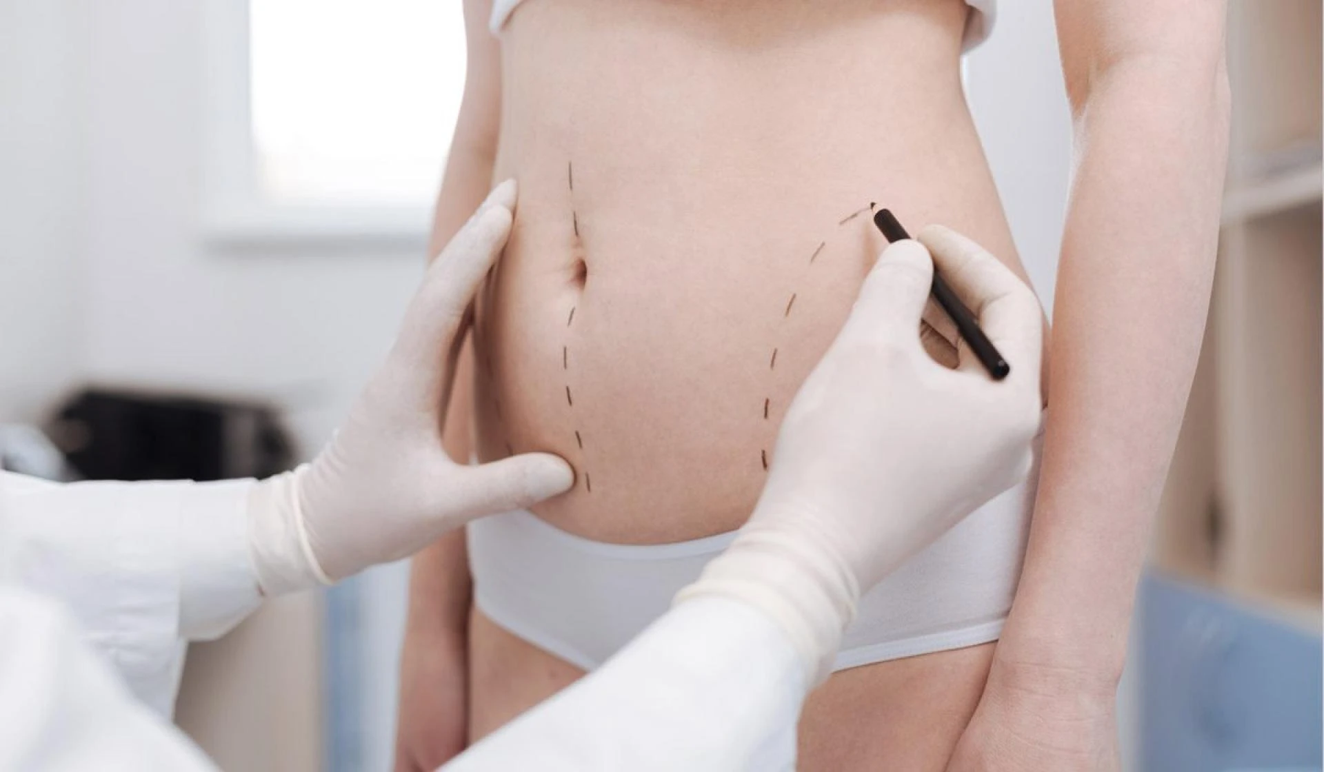Highly Qualified Liposuction Experts Among the Best Doctors in Dubai