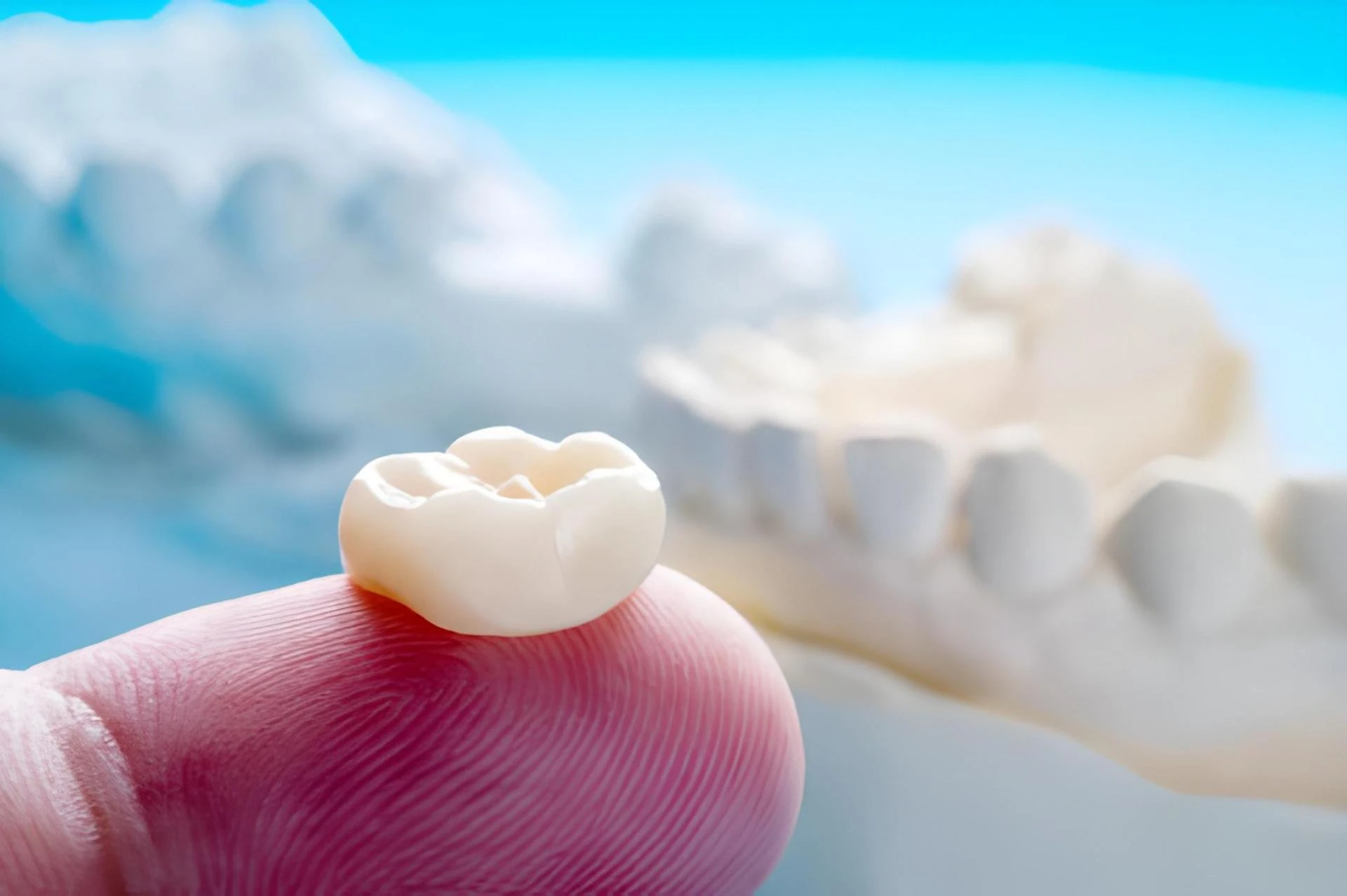 Natural-Looking Porcelain Crowns: Advanced Restorations at Dental Care Center of South Kansas City