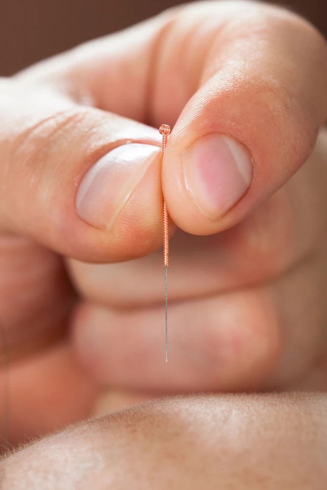 Why Acupuncture Is Effective for Stress-Induced Neck Inflammation
