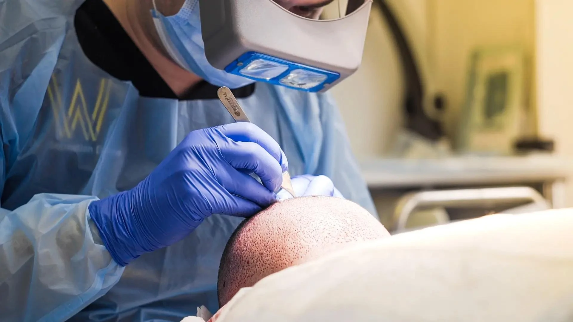 Hair Transplant UK: Tracking and Maintaining Hair Growth