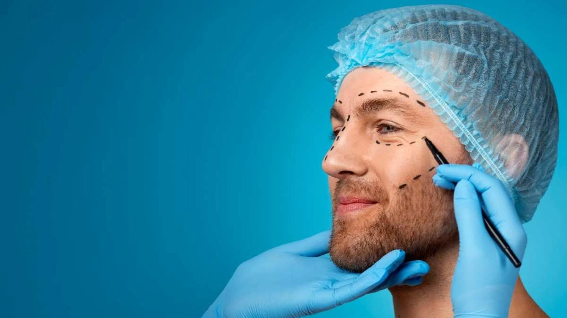 Face Lift Surgery Cape Town: A Guide to Safe Recovery
