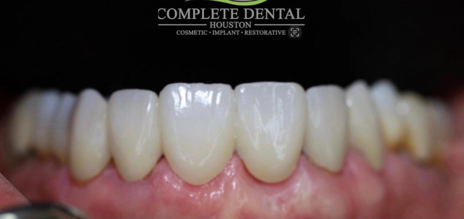 How the Best Dentist in Houston Delivers Stunning Cosmetic Results?