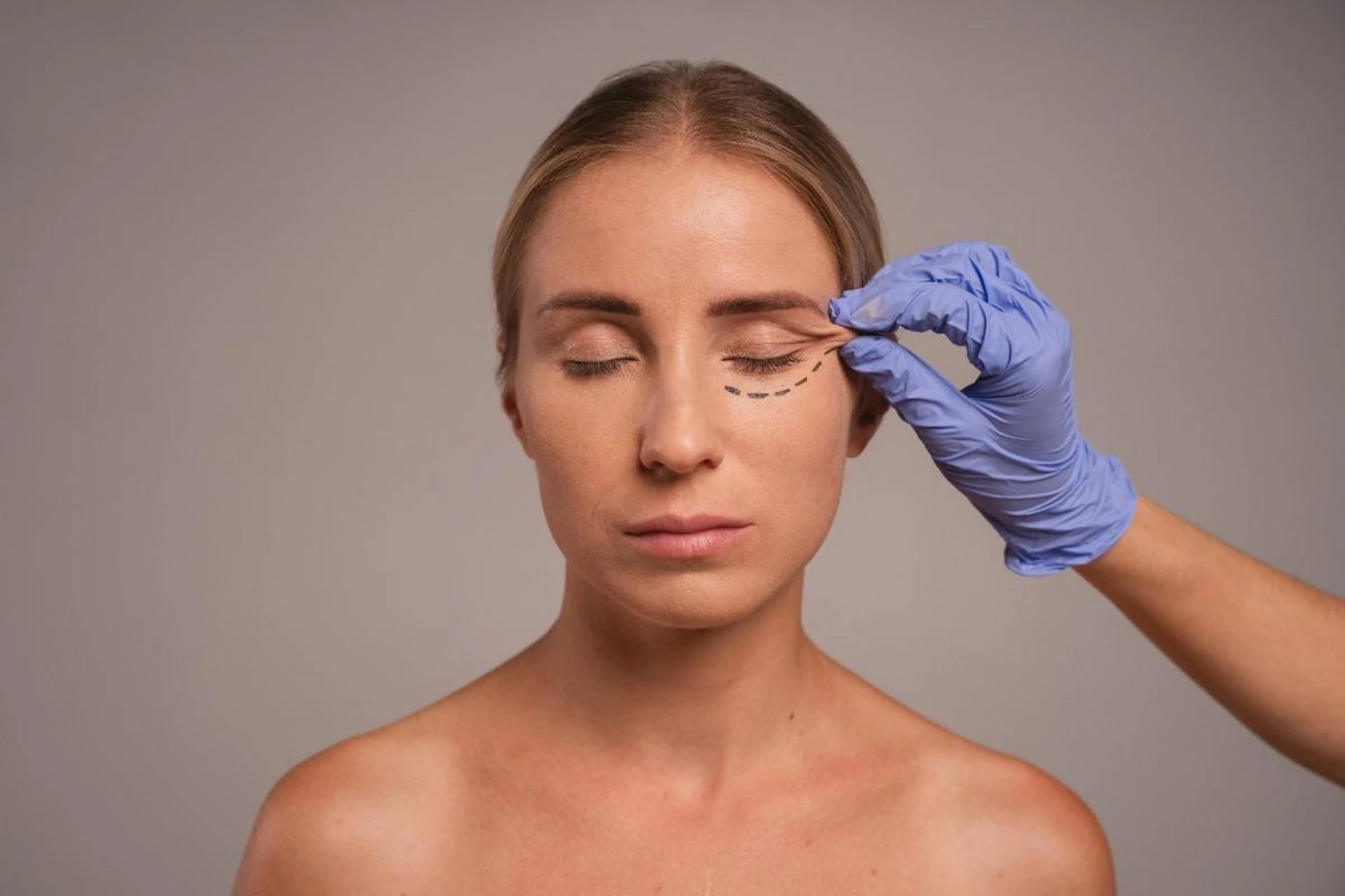 Blepharoplasty for International Patients: Travel & Treatment Guide