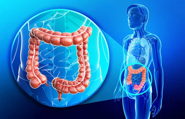 Colorectal Cancer Awareness and Advanced Colorectal Surgery in Delhi
