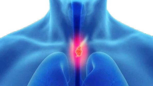 Comprehensive Guide to Esophageal Disorders and Advanced Esophagus Surgery in Delhi