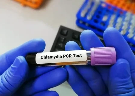 Chlamydia Test in Dubai: Can You Get Tested Without Symptoms
