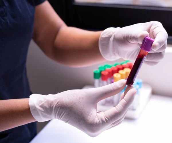How to Become a Certified Phlebotomist in Ontario: Step-by-Step Guide for 2026