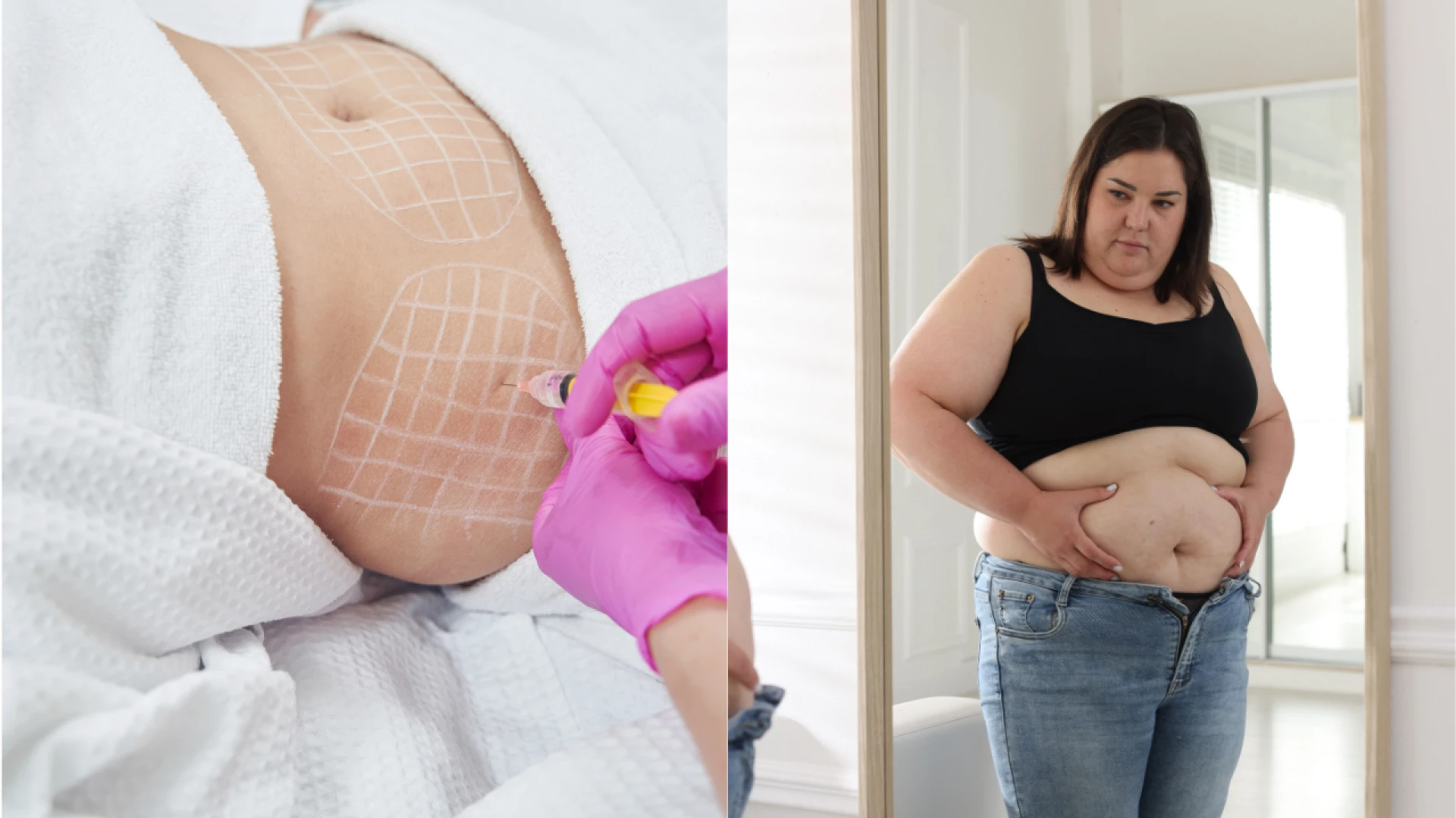 9 Benefits of Choosing Fat Dissolving Injections Near Me