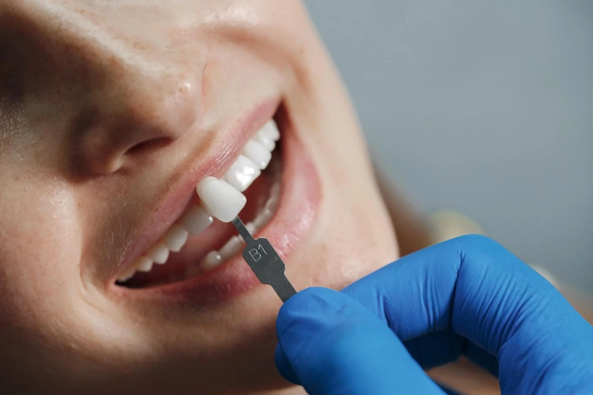 How Dental Implants Restore Your Smile and Confidence