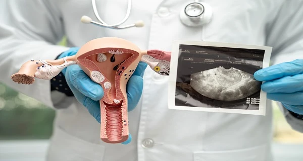 Advanced Bladder Cancer and Kidney Stone Treatment in Delhi