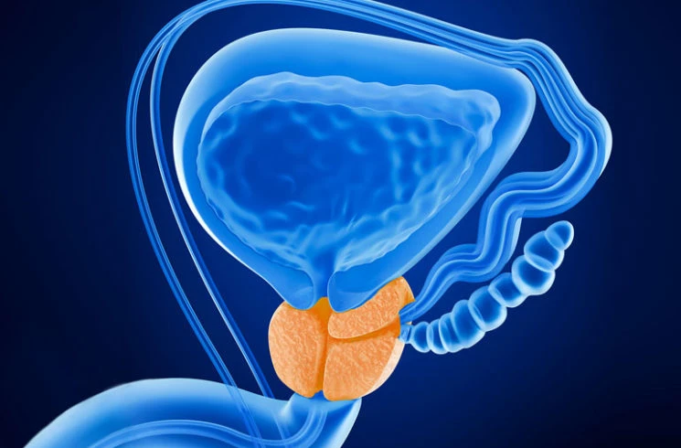 Prostate Cancer Biospecimens: Fueling Innovation in Pharma and Biotech