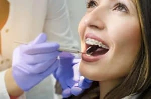 What do most people miss before getting braces in Los Angeles?
