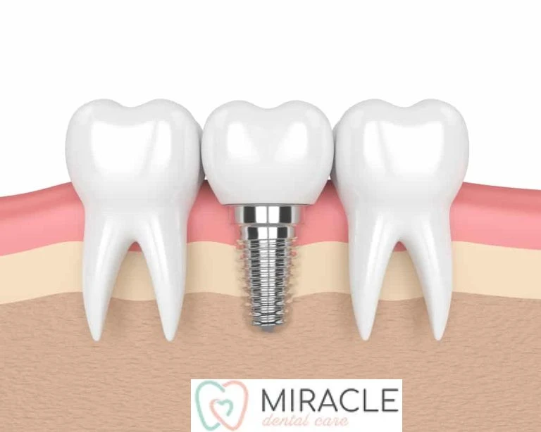 Comprehensive Dental Care in Yokine, Balcatta, Dianella & Joondanna