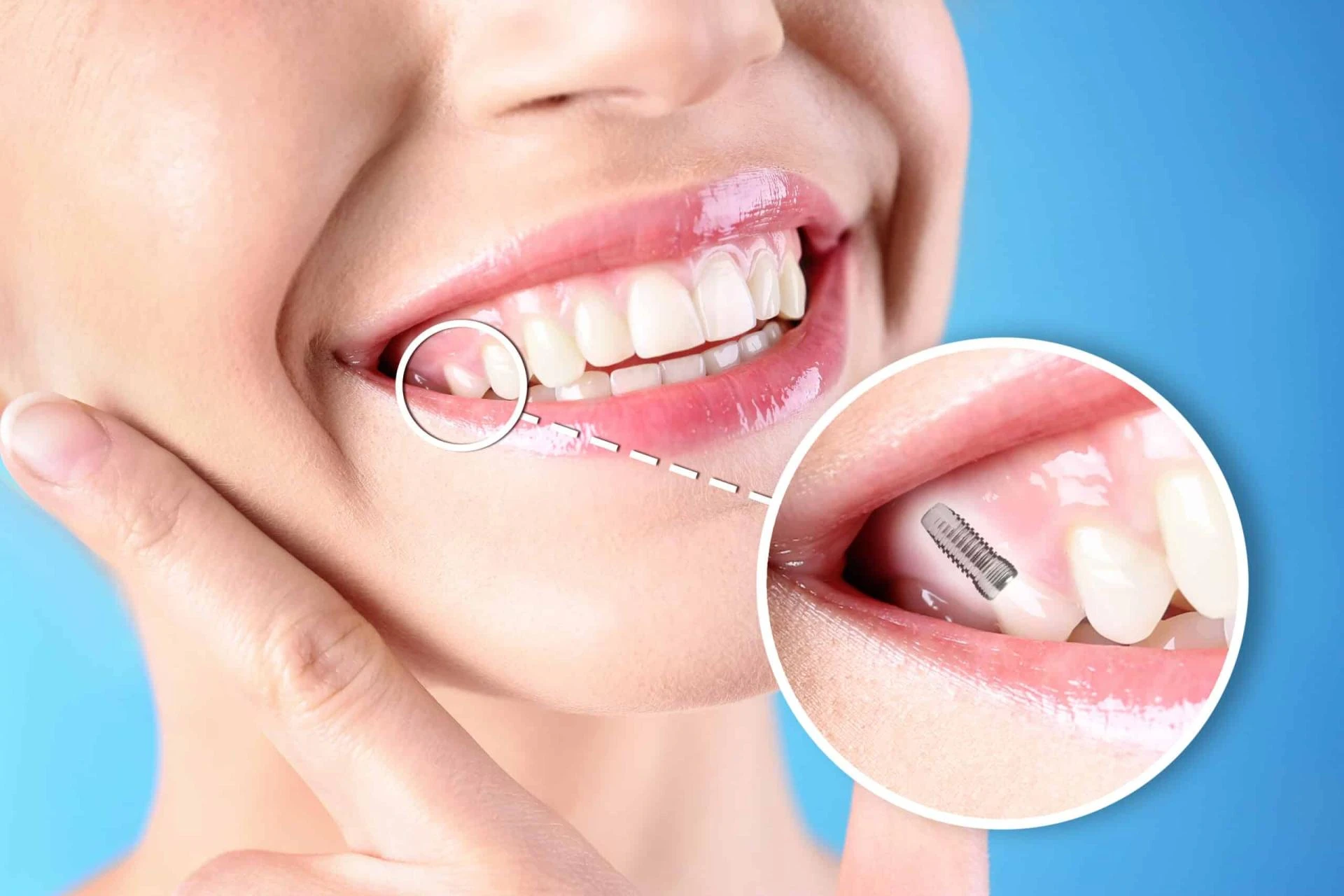 A New Lease on Dental Health: Permanent Solutions in Tirupati