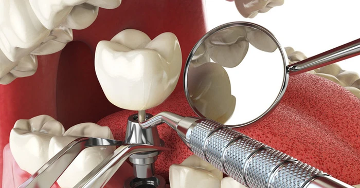 Affordable Oral Surgery Near Me: A Practical Guide to Safe and Budget-Friendly Treatment