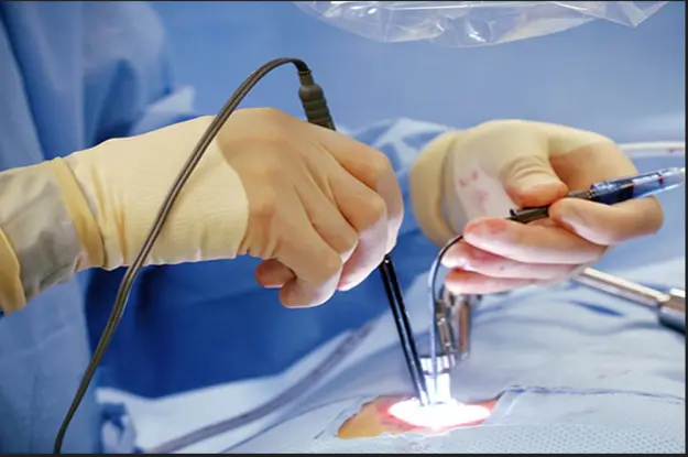 Advanced Healing Guide: Pilonidal Sinus Treatment in Dadar for a Pain-Free Life