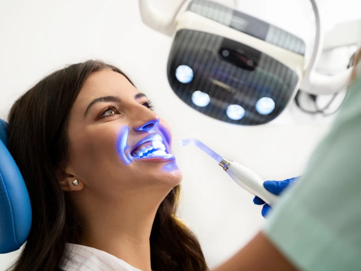 Top 5 Teeth Whitening Treatments That Actually Work