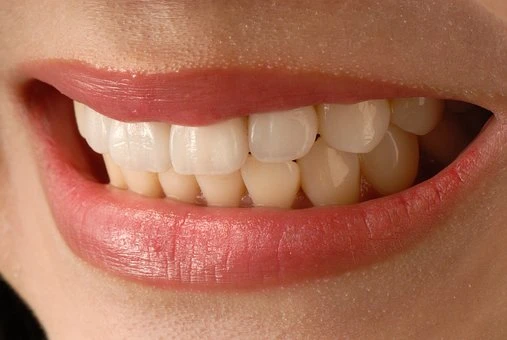 Why Plano Residents Are Choosing Lip Repositioning for Gummy Smiles