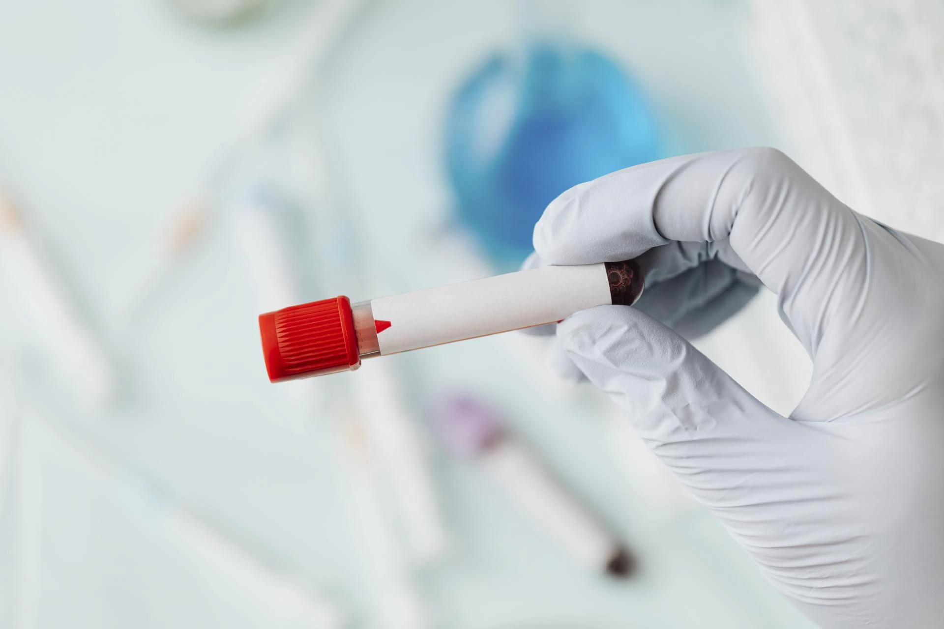 What Does a Full Wellness Blood Panel Actually Test For?