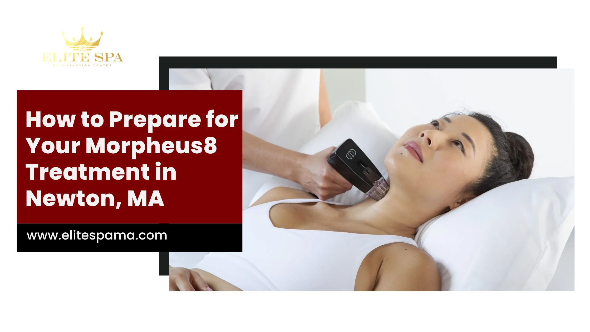 How to Prepare for Your Morpheus8 Treatment in Newton, MA