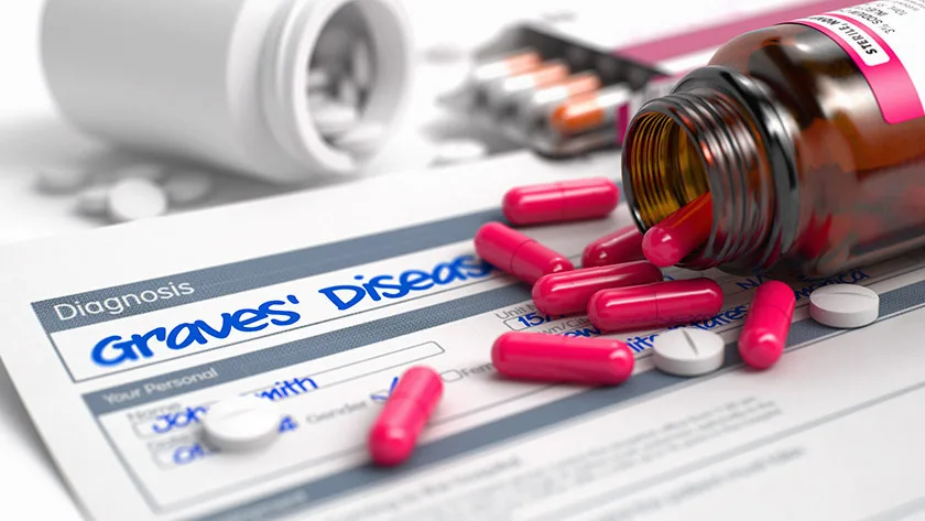 The Evolution of Graves' Disease Treatment Based on Recent Research