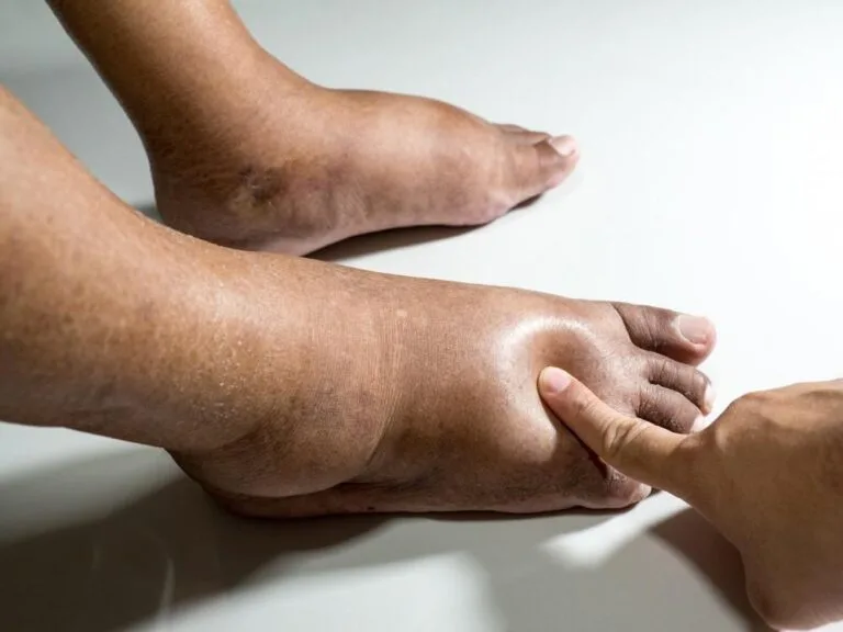 Vascular Surgeon Near Me for Advanced Vein Care Solutions
