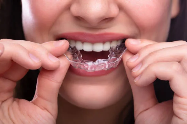 Discover the Benefits of Henrietta NY Invisalign for a Healthier Smile