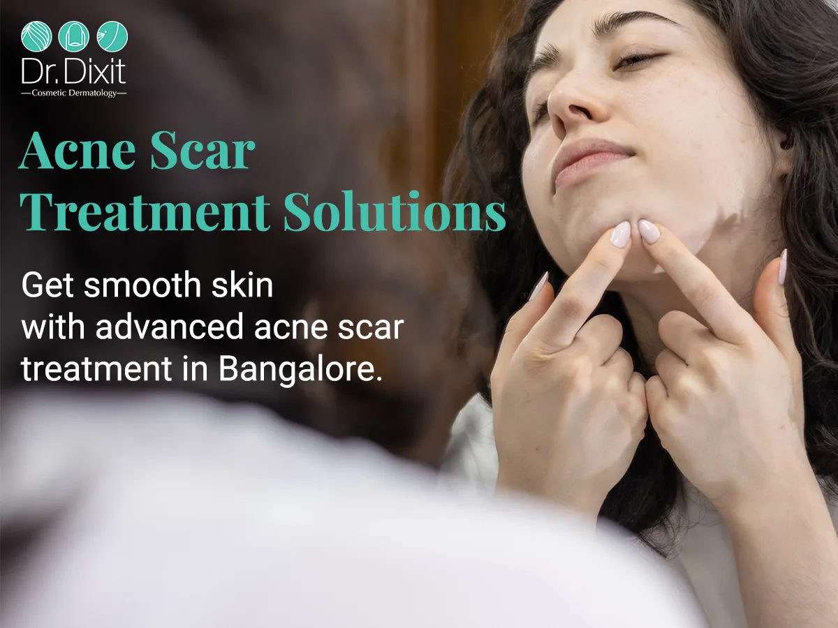 What are the Best Treatment Options for Pitted Acne Scars?