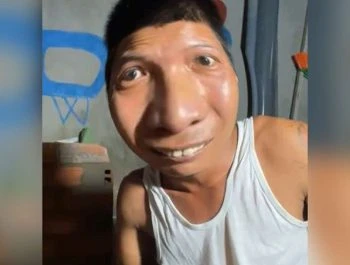 xoso