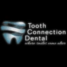 Tooth connection Dental